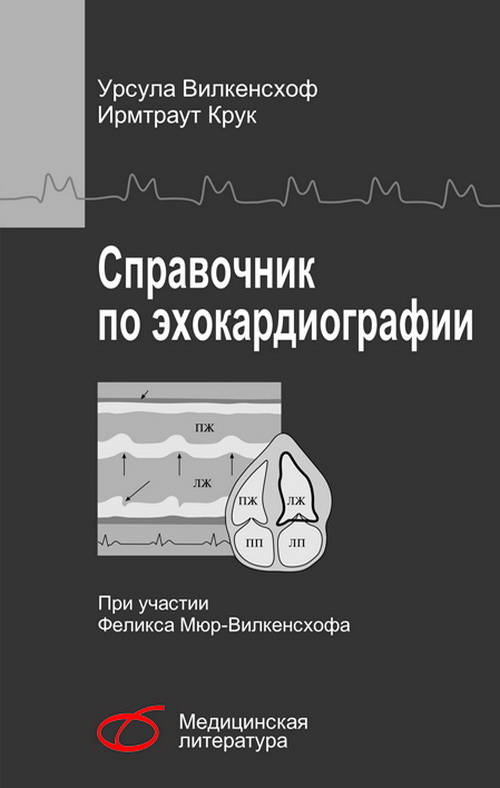 Архив : Справочник По Эхокардиографии